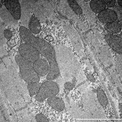Electron microscope image of mitochondria from turtle heart 